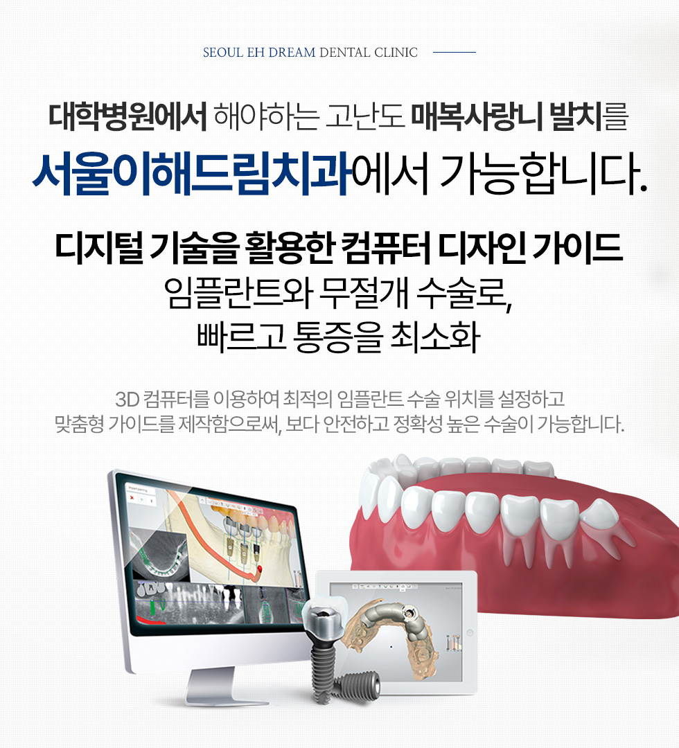 대학병원에서 해야하는 고난도 매복사랑니 발치를 서울이해드림치과에서 가능합니다.